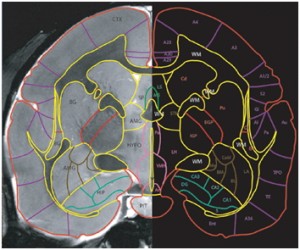 mri-atlas-2